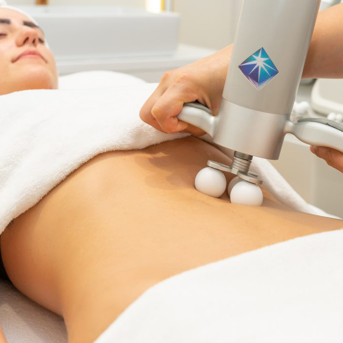 Tratamiento corporal Bellaction, la máquina sobre el vientre de una mujer